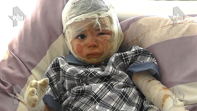 Коллектор сжег двухлетнего ребенка